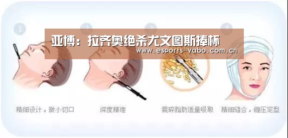 亚博:拉齐奥绝杀尤文图斯捧杯(图2) 亚博体育